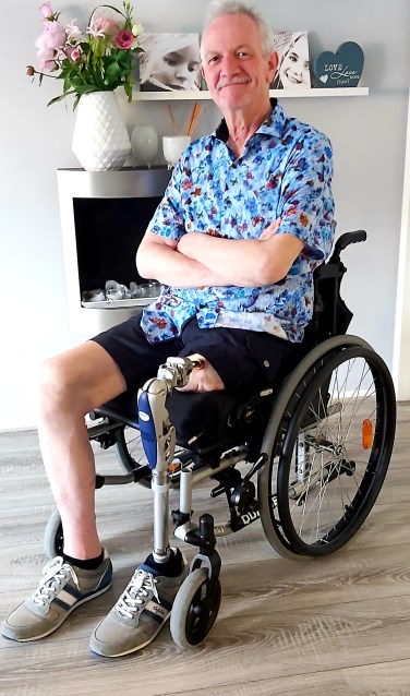 Gerard Kolenbrander met zijn klikprothese. Foto: PR