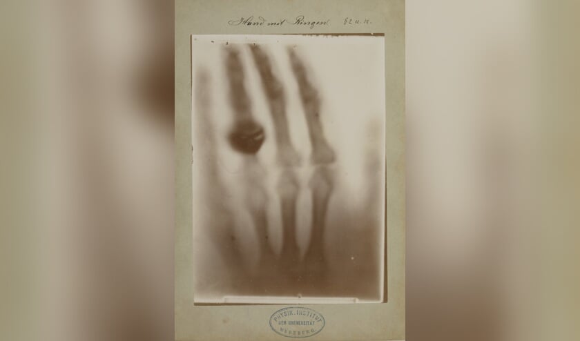 Röntgenfoto door Wilhelm Conrad Röntgen: hand van Röntgens vrouw, 22 december 1895.