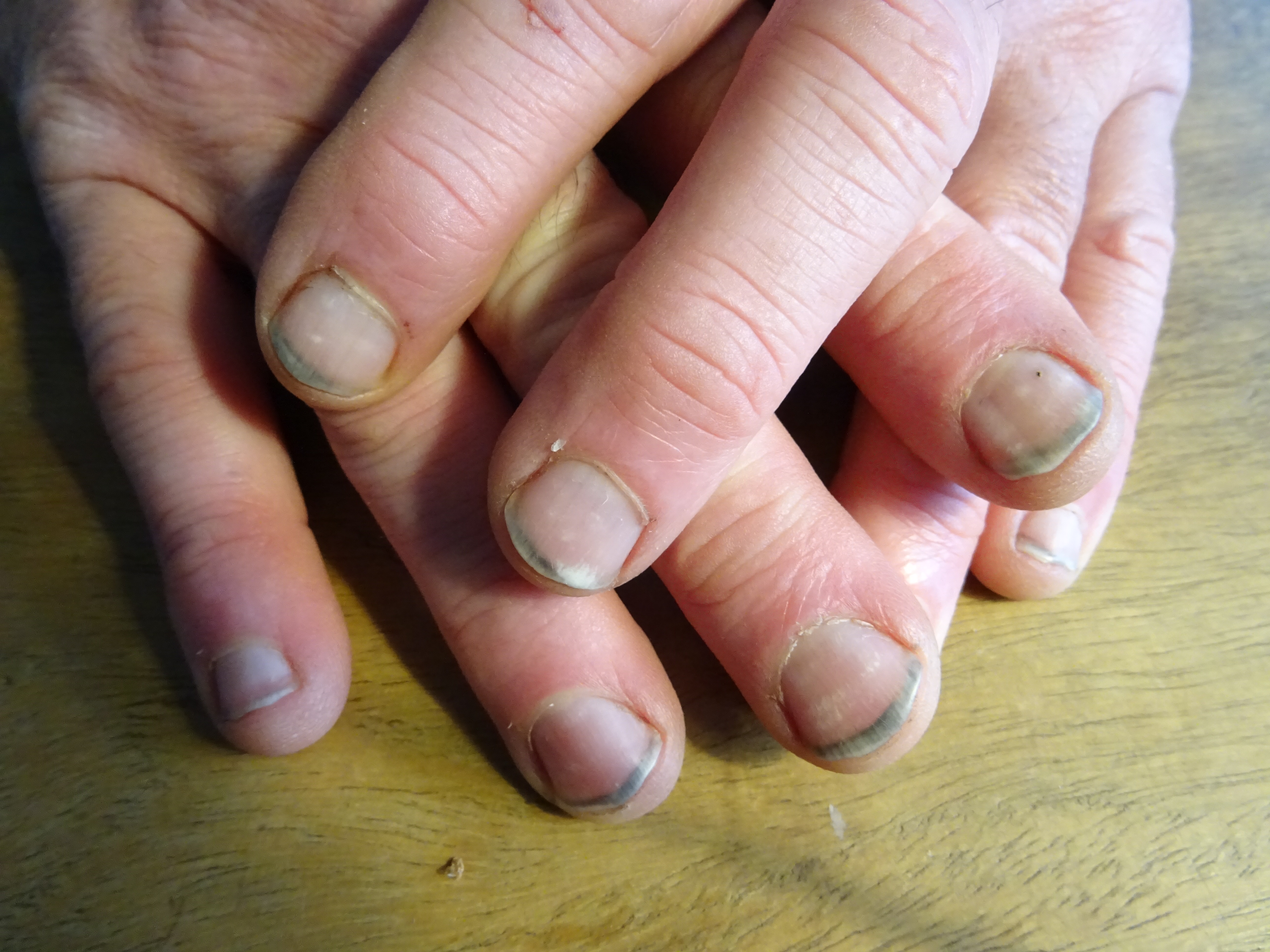 'Een portie zwarte nagels...' (aangeleverde foto)