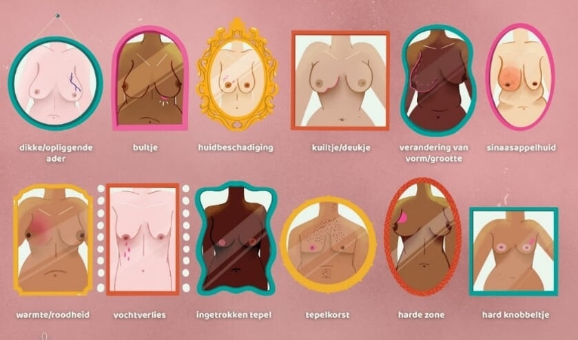 8 op de 10 vrouwen kent symptomen borstkanker niet